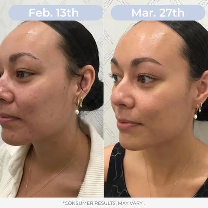 LAMD Liposomal Glutathione