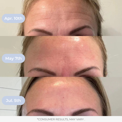 LAMD Liposomal Glutathione