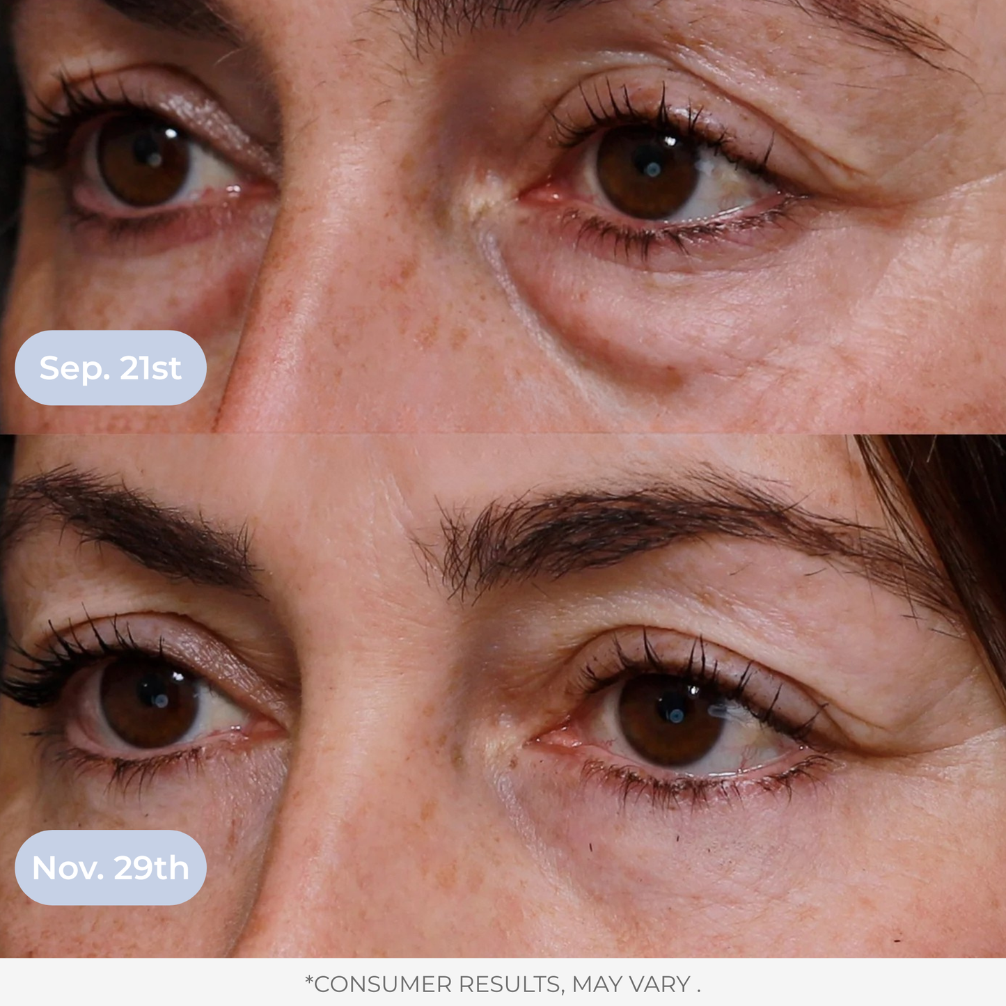 LAMD Liposomal Glutathione