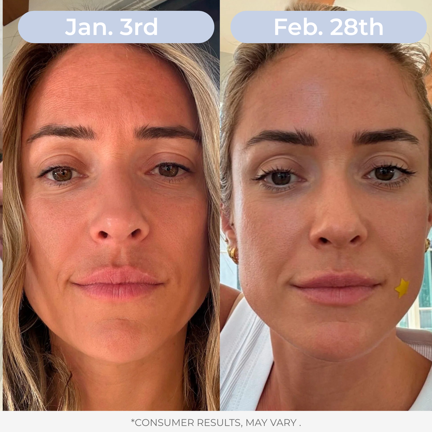 LAMD Liposomal Glutathione