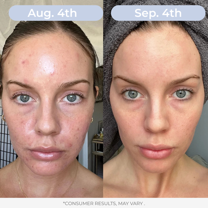 LAMD Liposomal Glutathione