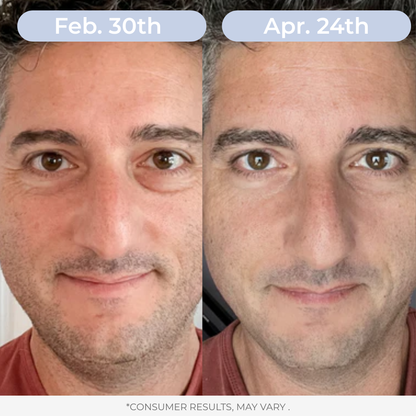 LAMD Liposomal Glutathione